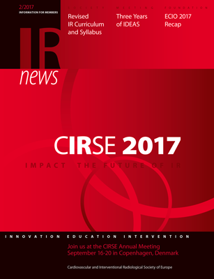 IRnews